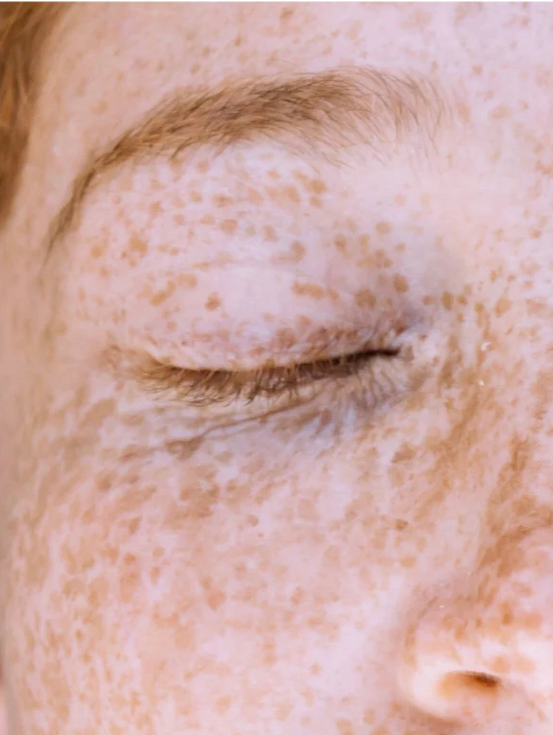 1% Kojisäure Gesichtscreme