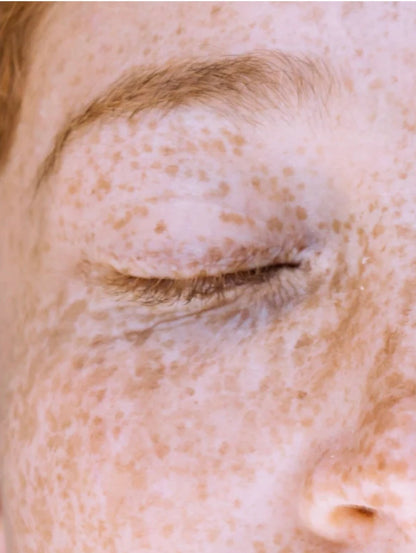 1% Kojisäure Gesichtscreme